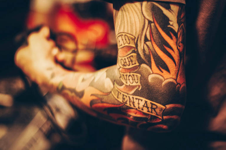 Tattoo Removal